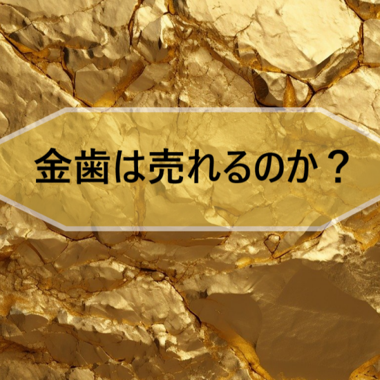 金歯は売れるのか？
